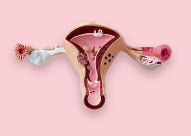 Wat is endometriose?